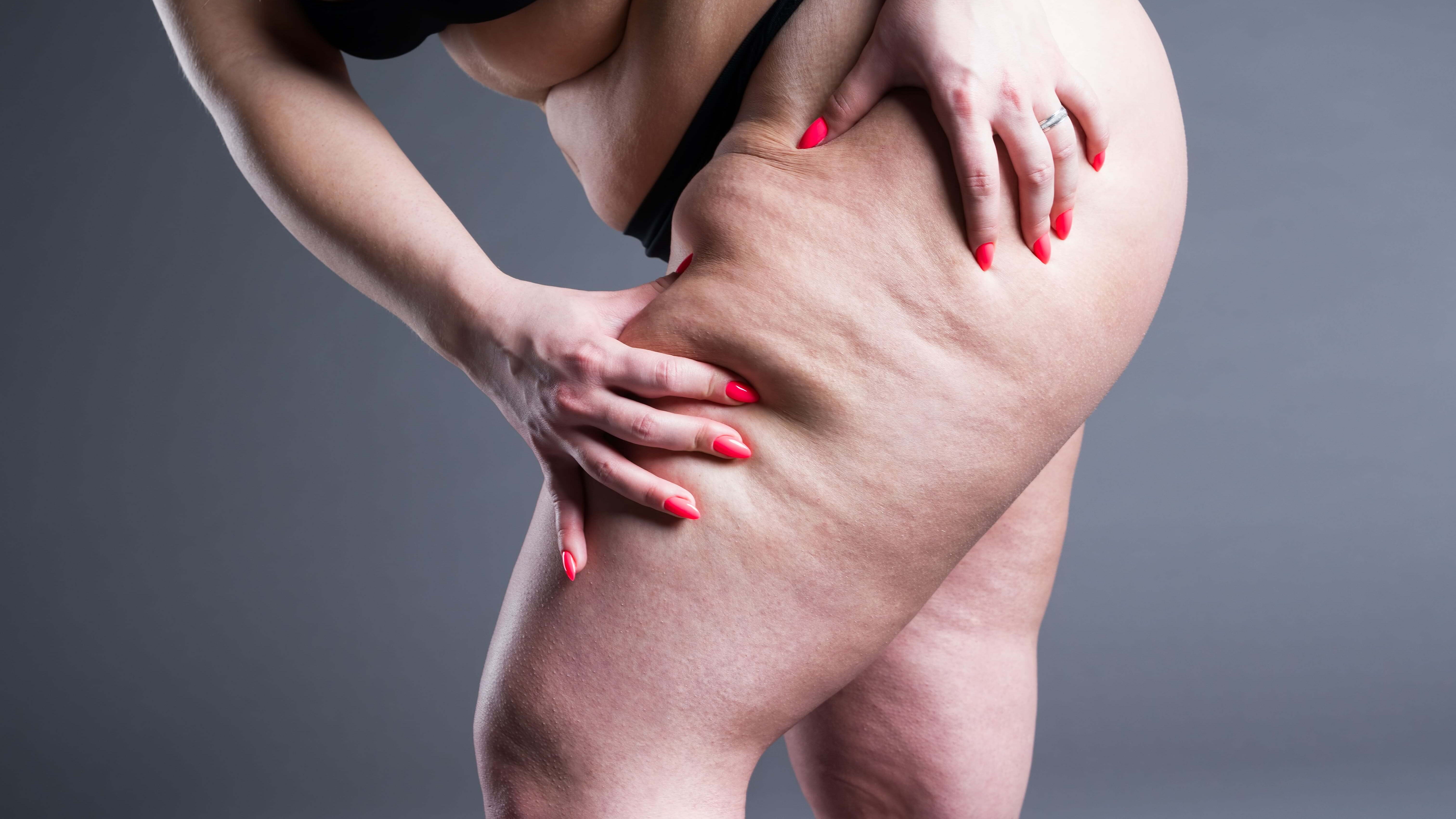 woman holding thigh